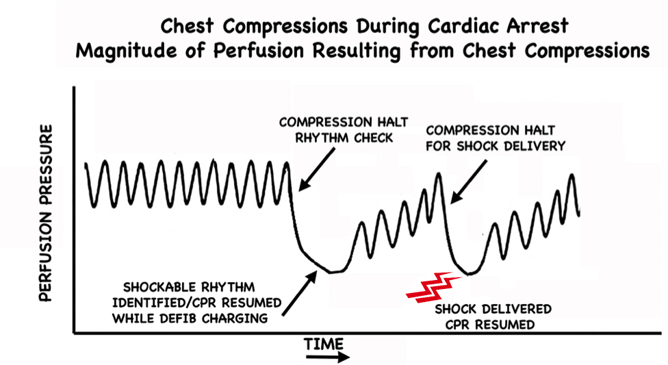 Pre-Charge the Defibrillator figure 1 