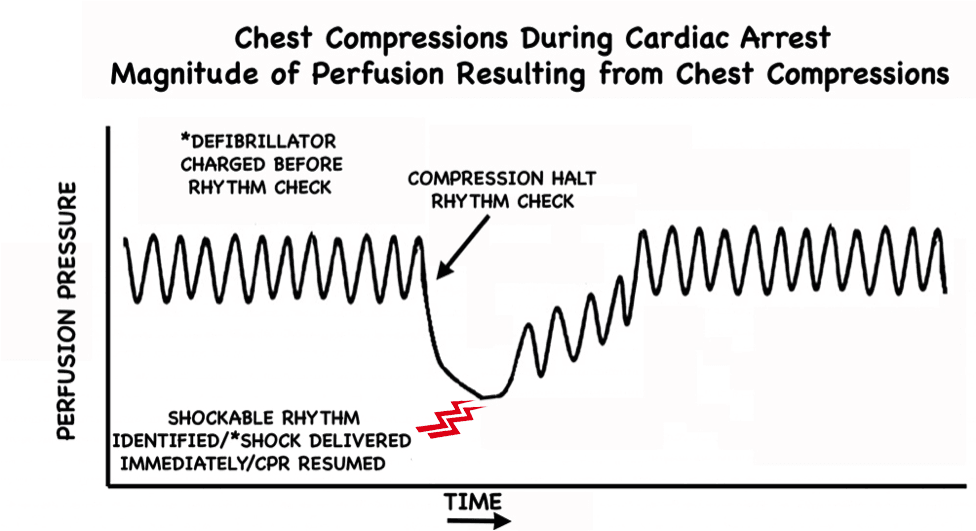 Pre-Charge the Defibrillator CPR Perfusion Pressure 2