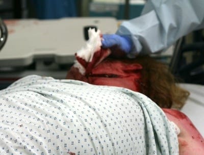 LacerationNeckAgitation5sm