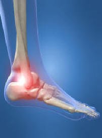 Lauge-Hansen Classification of Ankle fractures