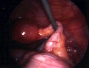 Appendix