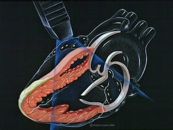 Cardiac Echo ultrasound