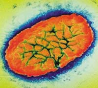 Pertussis Organism