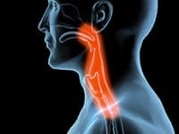 Dysphagia