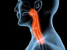 Dysphagia