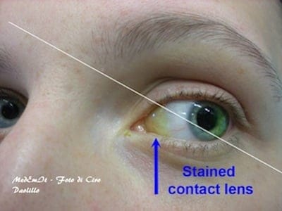 ContactlensYellowsm