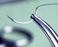 Suture