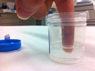 Urine Cup Finger