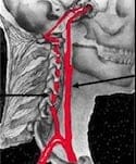 Cerebrovascular Anatomy