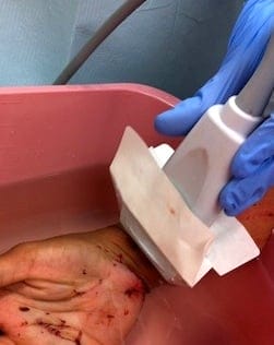 ultrasonography water bath