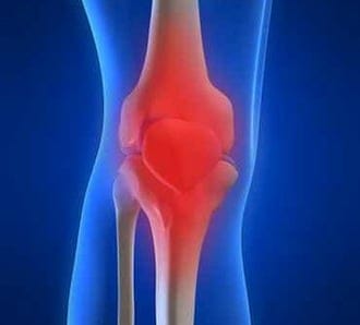 Knee Pain