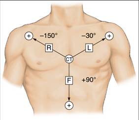 EKG vectors