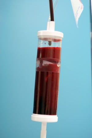 Blood transfusion Drip Chamber