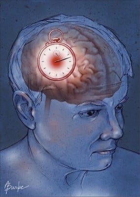 thrombolytics stroke