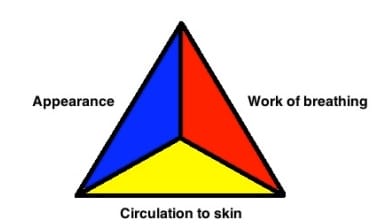 pediatric assessment triangle
