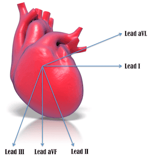 Heart & Lead aVL