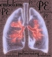 PE