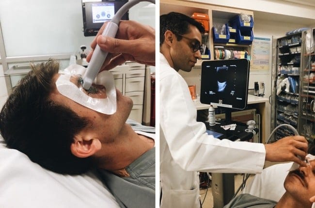 Ocular-ultrasound-setup