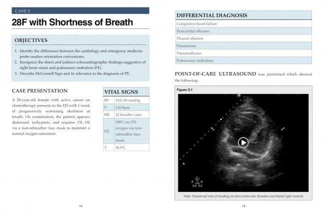 us4tw-book-preview