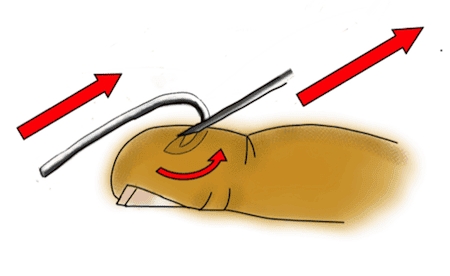 fishhook removal needle cover