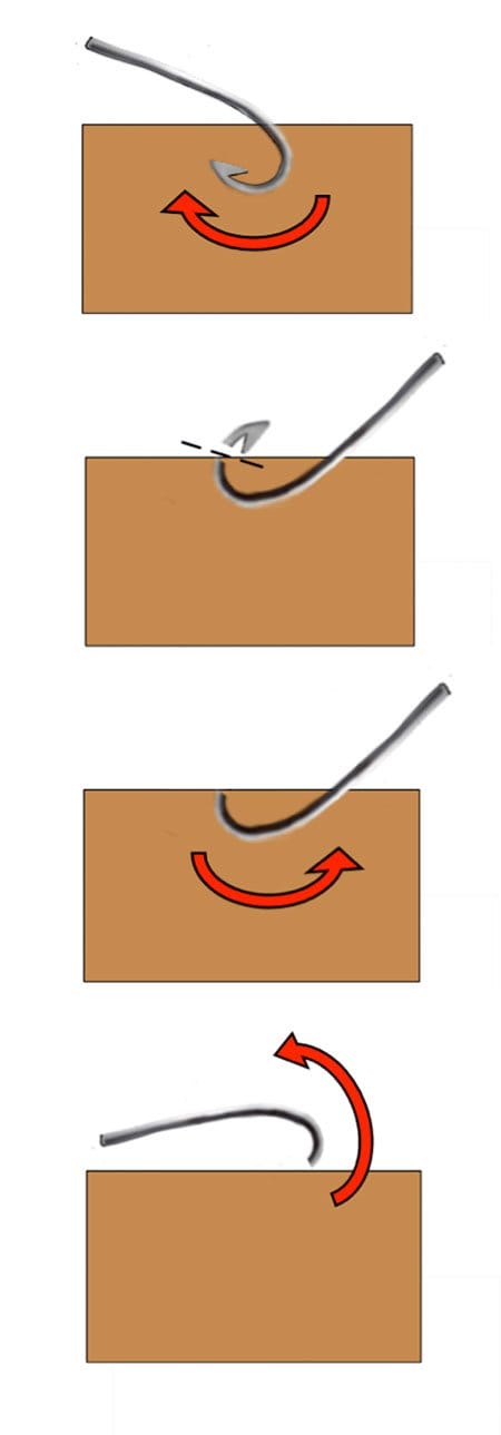 fishhook removal push through technique