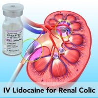 intravenous lidocaine for renal colic