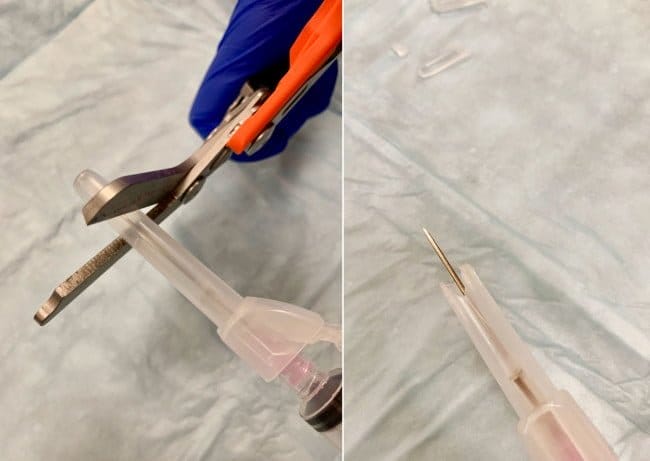 Needle-sheath-cut-jagged peritonsillar abscess drainage 