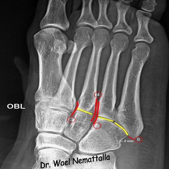 Ankle anatomy 1
