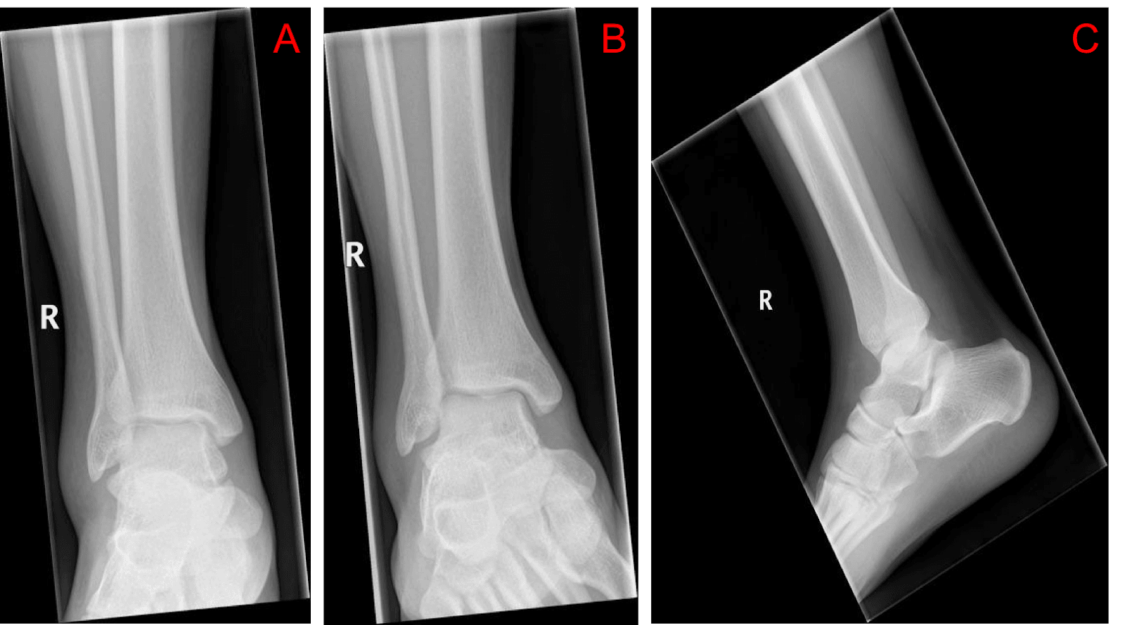 ankle anatomy