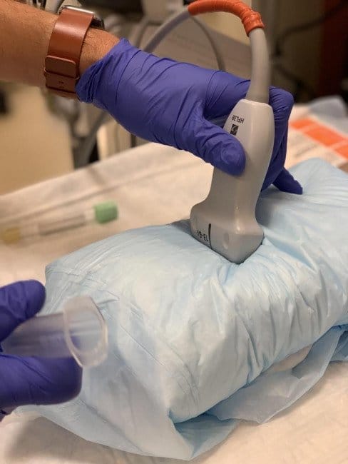 Ultrasound placement
