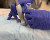 ultrasound-prob