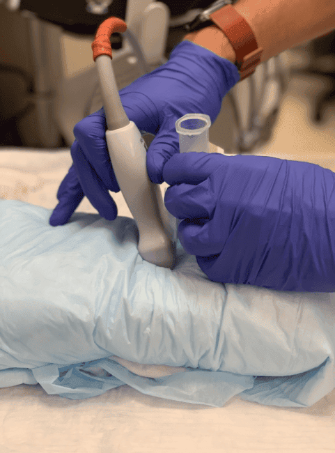 ultrasound probe