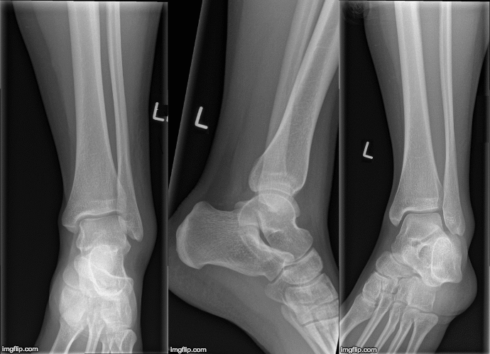 normal anke x-ray series