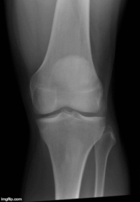 knee radiology