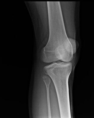 knee radiology