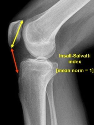 knee radiology