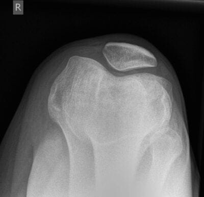 knee radiology