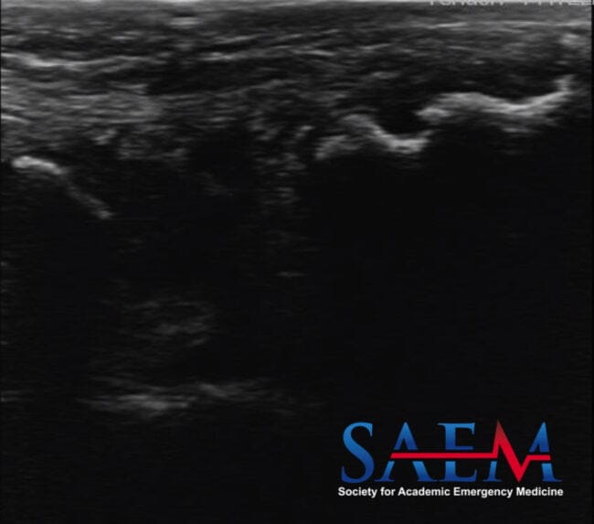 ultrasound