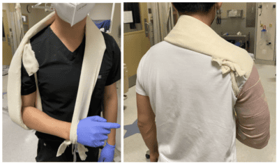 Coaptation Splint