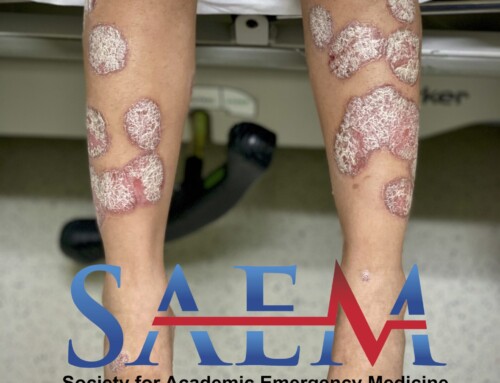 SAEM Clinical Image Series: Silver Scales