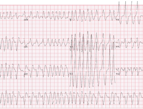Diagnosis on Sight: “I have a rapid heart rate”