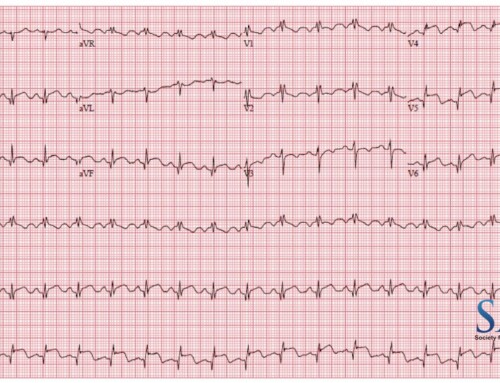 SAEM Clinical Image Series: A Young Woman with Chest Pain