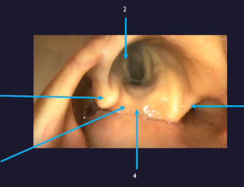 IDEA | Airway Series: Reviewing Intubation Footage in Conference to Improve Airway Mastery