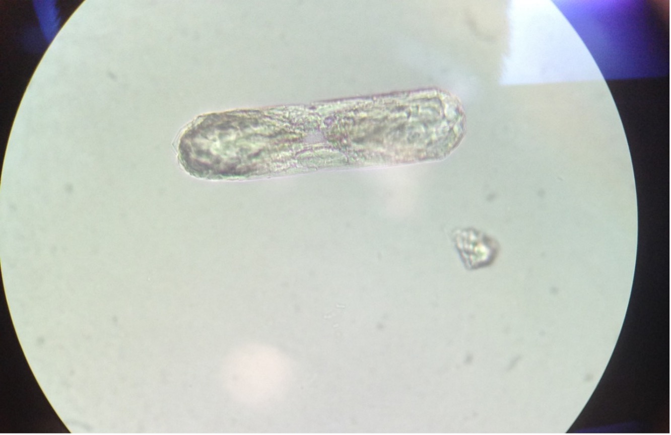 crystalluria primidone