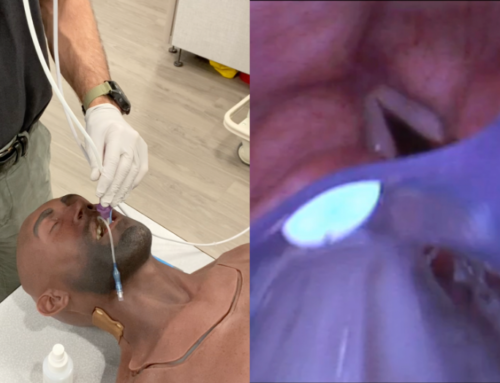 Trick of the Trade: A “Fiberbougie” through a supraglottic airway device (King tube)
