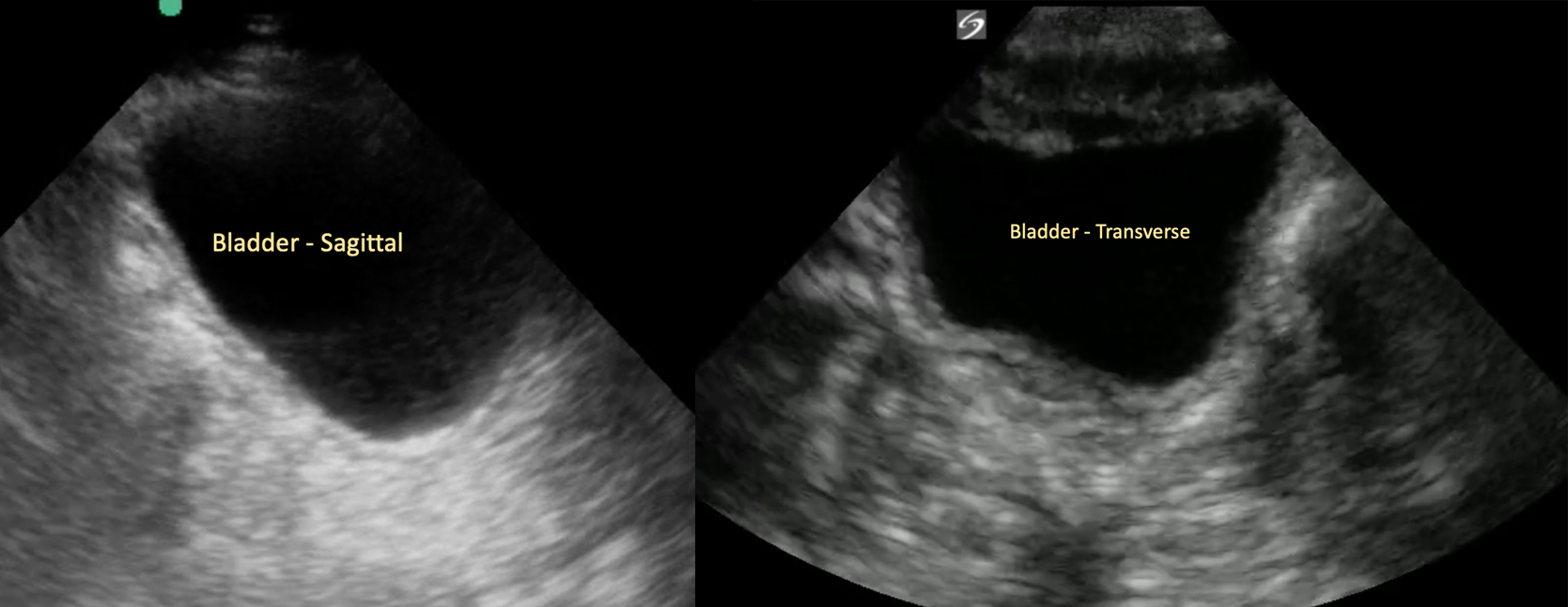 Normal pelvic ultrasound views