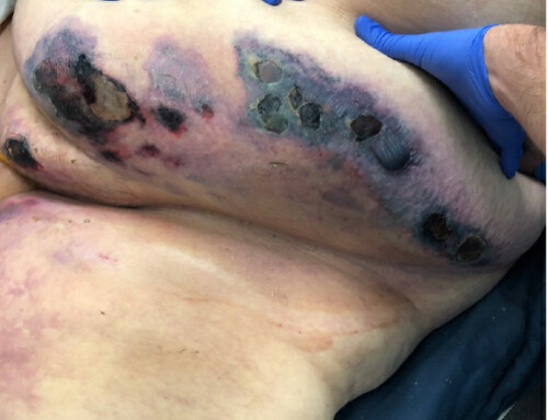SAEM Clinical Images Series: A Rash You Don’t Want to Miss