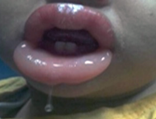 ACMT Toxicology Visual Pearl: Swollen Lips