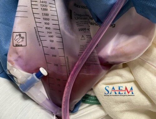 SAEM Clinical Images Series: The Color Purple