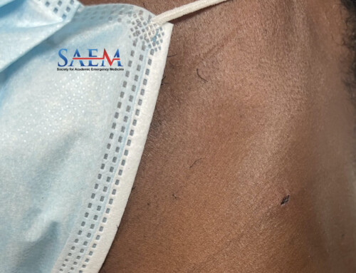 SAEM Clinical Images Series: Only a Flesh Wound